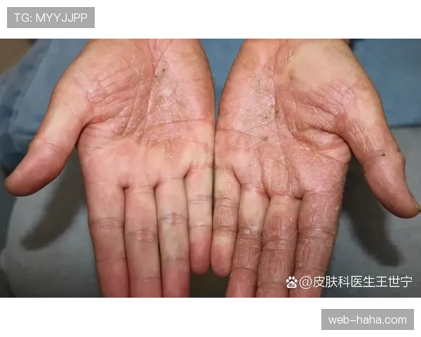 手部接触判定标准详解：怎样才算犯规与普通接触区别